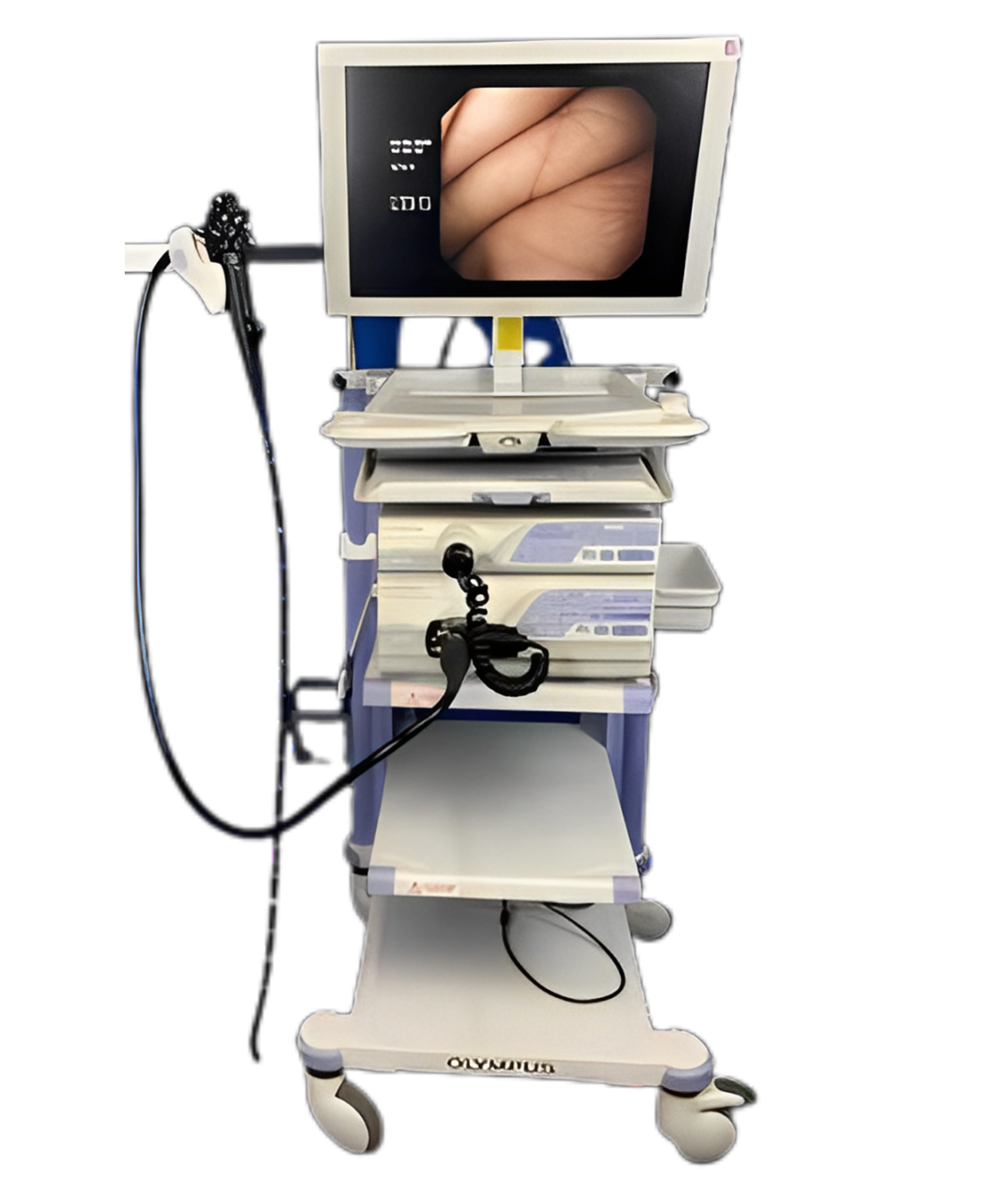 olympus-260-nbi-endoskopik-set