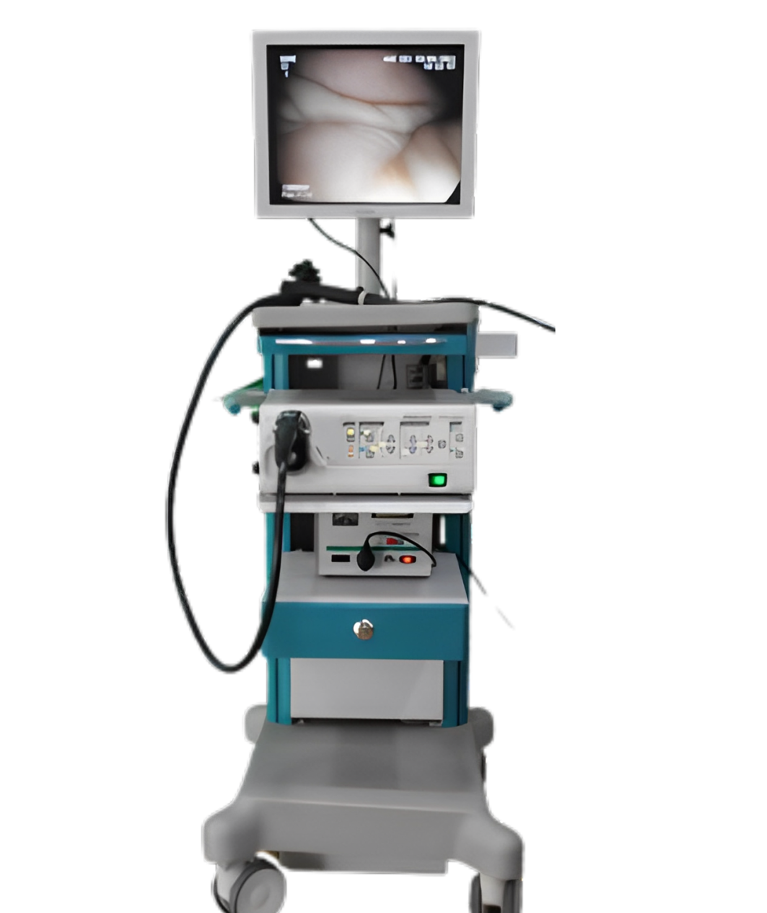 pentax-epk-1000-ntsc-endoskopik-set