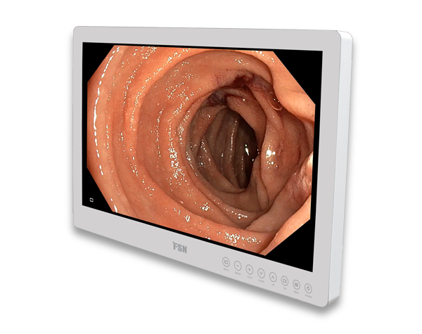 fsn-fs-e2101d-21.5-hd-tibbi-monitor