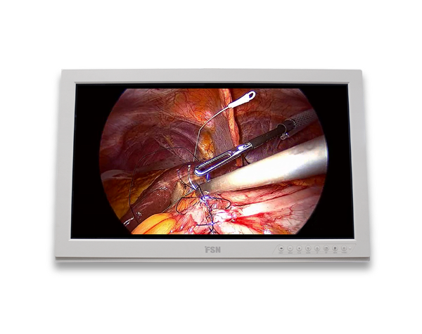 fsp2603d-26-full-hd-tibbi-monitor