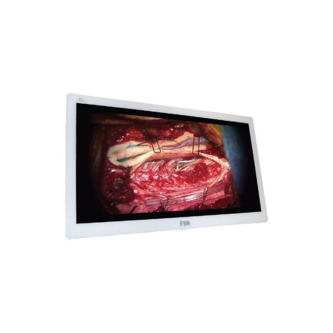 fsp3102ds-31-4k-uhd-tibbi-monitor