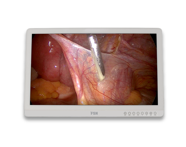 fma2701d-27-4k-uhd-tibbi-monitor